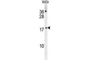 CHCHD2 Antibody (Center) western blot analysis in WiDr cell line lysates (35µg/lane). (CHCHD2 抗体  (Middle Region))