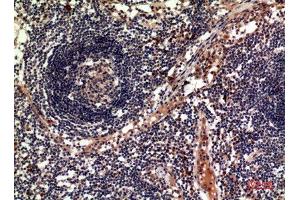 Immunohistochemistry (IHC) image for anti-Tumor Necrosis Factor (Ligand) Superfamily, Member 11 (TNFSF11) (C-Term) antibody (ABIN3187907)