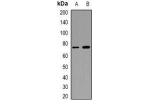 Western blot analysis of CD93 expression in KB (A), THP1 (B) whole cell lysates. (CD93 抗体)