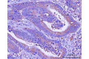IHC analysis of PTPIP51/RMDN3 using anti-PTPIP51/RMDN3 antibody (ABIN7601775).