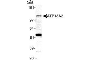 Western blot analysis of ATP13A2 in mouse brain membrane lysate ATP13A2 polyclonal antibody . (ATP13A2 抗体  (AA 200-300))