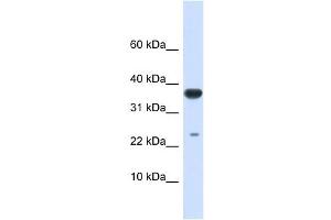 UBE2D2 antibody used at 1 ug/ml to detect target protein. (UBE2D2 抗体)