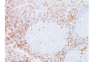 Formalin-fixed, paraffin-embedded human Tonsil stained with CD8 Mouse Monoclonal Antibody (C8/468). (CD8 alpha 抗体)