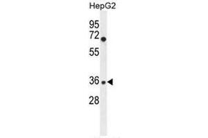 IGHG1 Antibody (Center) western blot analysis in HepG2 cell line lysates (35µg/lane). (IGHG1 抗体  (Middle Region))