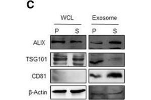 SDCSC exosomes are transported to bone marrows and increase neutrophil population in bone marrow.