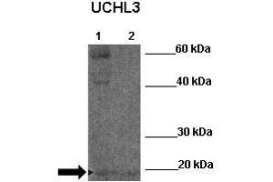 WB Suggested Anti-UCHL3 Antibody  Positive Control: Lane 1:341 µg Zebrafish skin lysate Lane 2: 041 µg Zebrafish liver lysate Primary Antibody Dilution: 1:0000Secondary Antibody: Anti-rabbit-HRP Secondry  Antibody Dilution: 1:0000Submitted by: William Tse (UCHL3 抗体  (N-Term))