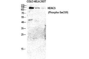 Western Blot (WB) analysis of COLO205 HeLa 293T cells using Phospho-HDAC5/9 (S259/220) Polyclonal Antibody. (HDAC5/9 (pSer220), (pSer259) 抗体)