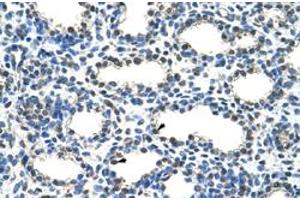 Immunohistochemical staining (Formalin-fixed paraffin-embedded sections) of human lung with ARIH2 polyclonal antibody  at 4-8 ug/mL working concentration. (ARIH2 抗体  (N-Term))