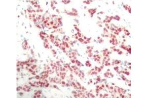 Immunohistochemistry (Paraffin-embedded Sections) (IHC (p)) image for anti-Nuclear Factor of kappa Light Polypeptide Gene Enhancer in B-Cells 2 (NFKB2) (pSer866) antibody (ABIN7265190)