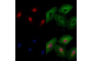 ABIN6259098 and ABIN6274122 staining  cells by IF/ICC.