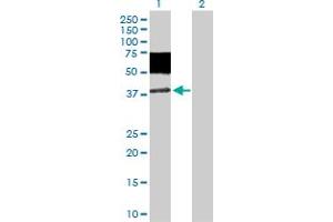Western Blot analysis of MICA expression in transfected 293T cell line by MICA MaxPab polyclonal antibody. (MICA 抗体  (AA 1-383))