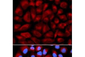 Immunofluorescence analysis of U2OS cells using FANCC Polyclonal Antibody (FANCC 抗体)