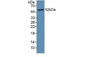Detection of Recombinant EGFR2, Human using Monoclonal Antibody to Receptor Tyrosine Protein Kinase erbB-2 (ErbB2) (ErbB2/Her2 抗体  (AA 376-578))
