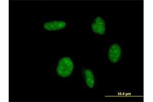 Immunofluorescence of monoclonal antibody to ATOH1 on HeLa cell. (ATOH1 抗体  (AA 266-354))