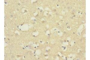 Immunohistochemistry of paraffin-embedded human brain tissue using ABIN7143380 at dilution of 1:100 (ADGRB1 抗体  (AA 60-350))