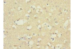 Immunohistochemistry of paraffin-embedded human brain tissue using ABIN7143380 at dilution of 1:100 (ADGRB1 抗体  (AA 60-350))