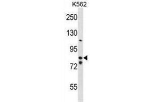 BACH2 Antibody (Center) western blot analysis in K562 cell line lysates (35µg/lane). (BACH2 抗体  (Middle Region))