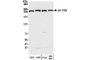 Western Blotting (WB) image for anti-Cytoskeleton Associated Protein 5 (CKAP5) (AA 1982-2032) antibody (ABIN7450111) (CKAP5 抗体  (AA 1982-2032))