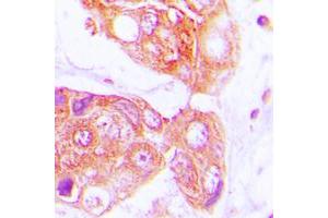 Immunohistochemistry (IHC) image for anti-DnaJ (Hsp40) Homolog, Subfamily B, Member 1 (DNAJB1) (C-Term) antibody (ABIN7295938)