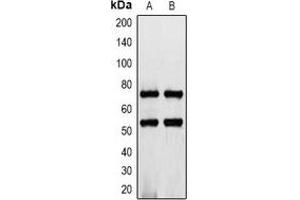 Western blot analysis of CD127 expression in K562 (A), rat heart (B) whole cell lysates. (IL7R 抗体  (C-Term))