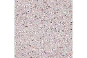Immunohistochemistry of paraffin-embedded mouse brain using TLK1 antibody (ABIN7270859) at dilution of 1:100 (40x lens). (TLK1 抗体  (AA 160-230))