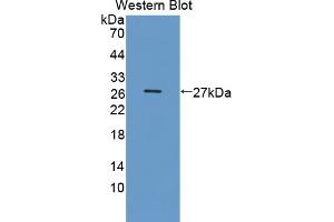 Detection of Recombinant DDC, Human using Polyclonal Antibody to Dopa Decarboxylase (DDC)
