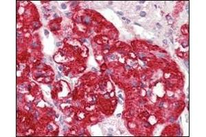 Immunohistochemical analysis of paraffin-embedded human adrenal tissues using STYK1/NOK antibody with DAB staining. (STYK1 抗体)