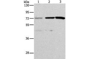 Western Blot analysis of Hela and SKOV3 cell, Mouse liver tissue using ALS2CR11 Polyclonal Antibody at dilution of 1:500 (ALS2CR11 抗体)
