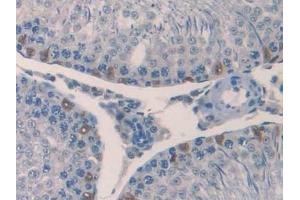 Immunohistochemistry (IHC) image for anti-Interleukin 18 (IL18) (AA 37-194) antibody (ABIN7429634)