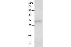 Western Blotting (WB) image for Calcitonin-Related Polypeptide alpha (CALCA) (AA 26-128) protein (His-IF2DI Tag) (ABIN7122081) (CGRP Protein (AA 26-128) (His-IF2DI Tag))