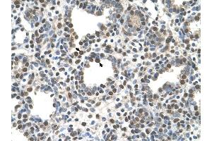Immunohistochemistry (IHC) image for anti-Zinc Finger, DHHC-Type Containing 13 (ZDHHC13) (N-Term) antibody (ABIN630234)