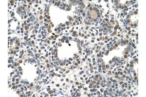 ZDHHC13 antibody was used for immunohistochemistry at a concentration of 4-8 ug/ml to stain Alveolar cells (arrows) in Human Lung. (ZDHHC13 抗体  (N-Term))