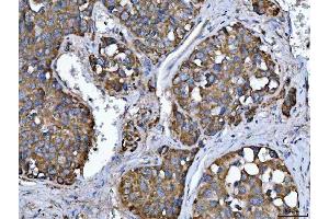 IHC analysis of TMPRSS13 using anti-TMPRSS13 antibody (ABIN7599797).