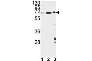 ATF6B 抗体  (AA 560-589)