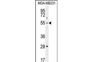 P1 Antibody (Center) (ABIN655817 and ABIN2845241) western blot analysis in MDA-M cell line lysates (35 μg/lane). (MMP1 抗体  (AA 317-347))