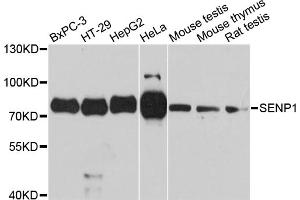 Western blot analysis of extracts of various cell lines, using SENP1 antibody. (SENP1 抗体)