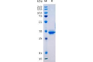 SDS-PAGE (SDS) image for Transmembrane 4 L Six Family Member 1 (TM4SF1) protein (Fc Tag) (ABIN6964380)