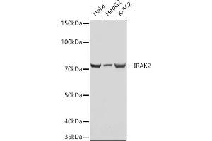 Western blot analysis of extracts of various cell lines, using IR Rabbit mAb (ABIN7268009) at 1:1000 dilution.
