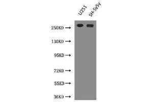 Western Blot Positive WB detected in: U251 whole cell lysate, SH-SY5Y whole cell lysate All lanes: NES antibody at 3 μg/mL Secondary Goat polyclonal to Mouse IgG at 1/10000 dilution Predicted band size: 178 kDa Observed band size: 260 kDa