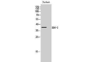 Western Blotting (WB) image for anti-BUD31 Homolog (BUD31) (N-Term) antibody (ABIN3174866) (BUD31 抗体  (N-Term))