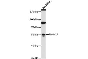 Western blot analysis of extracts of rat kidney, using RBMY1F antibody (ABIN7270095) at 1:1000 dilution. (RBMY1F 抗体  (AA 1-80))