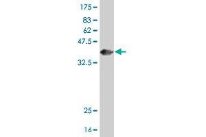Western Blot detection against Immunogen (36. (HOXA4 抗体  (AA 181-270))