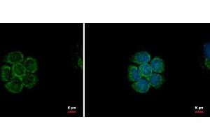 ICC/IF Image mTOR antibody detects mTOR protein at cytoplasm and nucleus by immunofluorescent analysis.