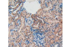 IHC-P analysis of kidney tissue, with DAB staining. (Osteocalcin 抗体  (AA 11-98))