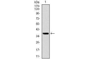 Western Blotting (WB) image for anti-Forkhead Box O1 (FOXO1) antibody (ABIN969521)