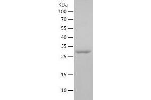 Western Blotting (WB) image for FER Tyrosine Kinase (FER) (AA 1-235) protein (His tag) (ABIN7122905)