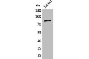 Western Blot analysis of Jurkat cells using PREP Polyclonal Antibody (PREP 抗体  (N-Term))