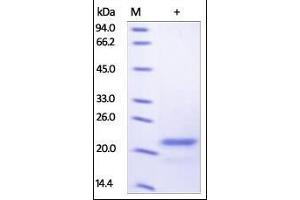SDS-PAGE (SDS) image for Sonic Hedgehog (SHH) (AA 24-197) protein (His tag) (ABIN2181760)