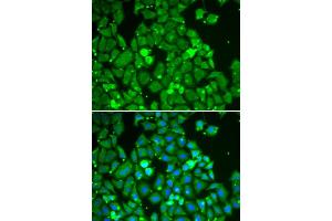 Immunofluorescence analysis of HeLa cell using STAT1 antibody. (STAT1 抗体)