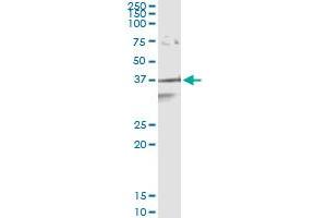 APEX1 (Human) IP-WB Antibody Pair